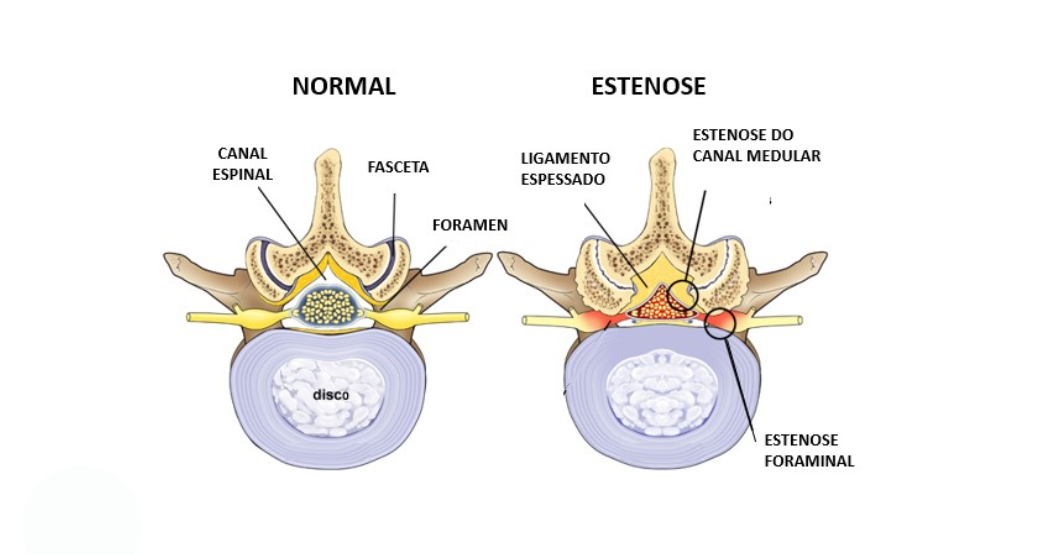 Temperos Naturais: Seu Arsenal Anti-inflamatório na Cozinha - inspiração 1
