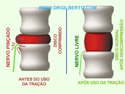 Açúcares e Refinados: Os Vilões que Aceleram o Desgaste - inspiração 2