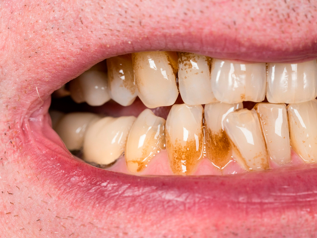 O Poder do Chá Verde: Polifenóis Combatendo as Bactérias da Placa - inspiração 2