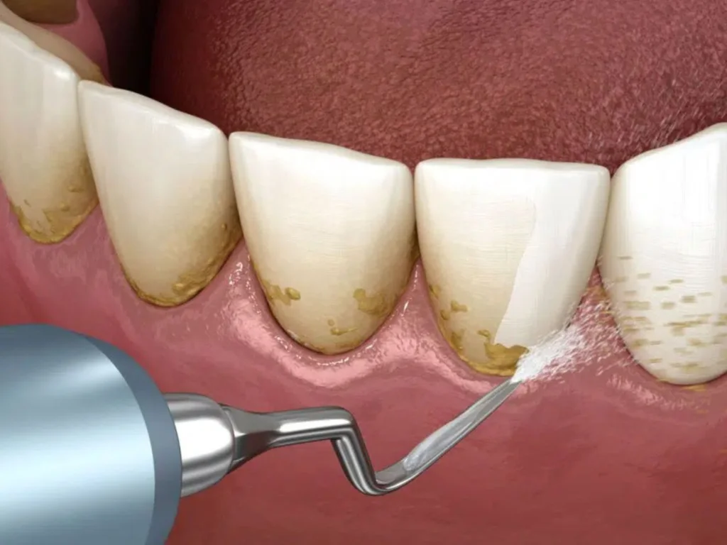 Aipo/Salsão: O 'Fio Dental' Natural Que Você Vai Adorar Morder - inspiração 2