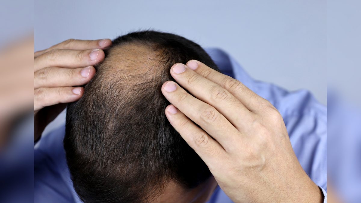 Bebidas Alcoólicas e Farinha Branca: Desvendando o Impacto no Seu Cabelo - inspiração 2
