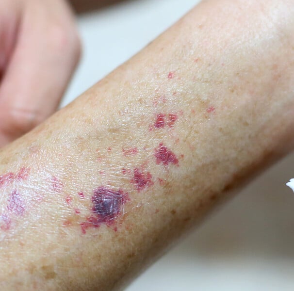 Vitamina C: O Escudo Antioxidante e Amigo das Plaquetas - inspiração 1