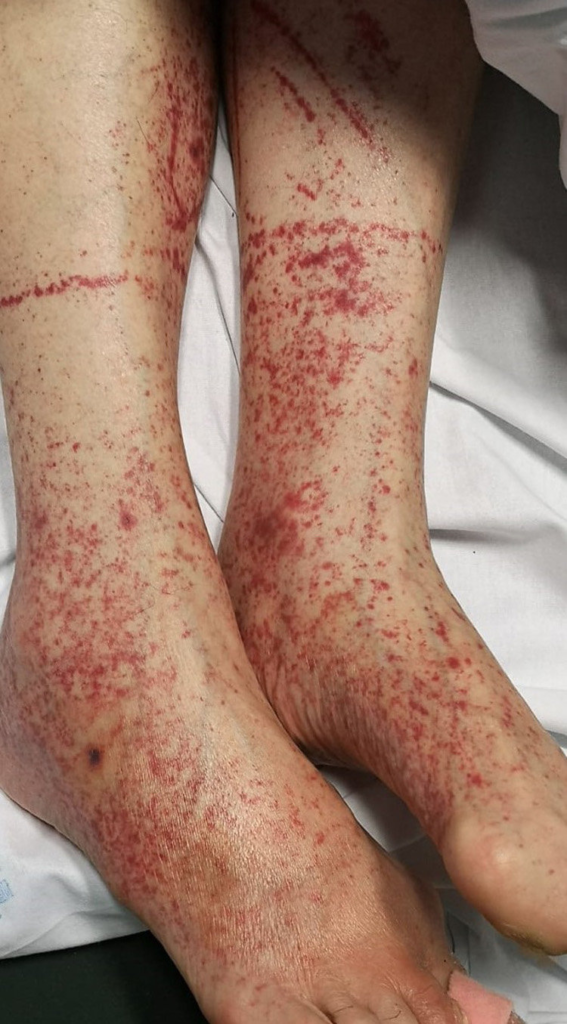 Vitamina C: O Escudo Antioxidante e Amigo das Plaquetas - inspiração 2