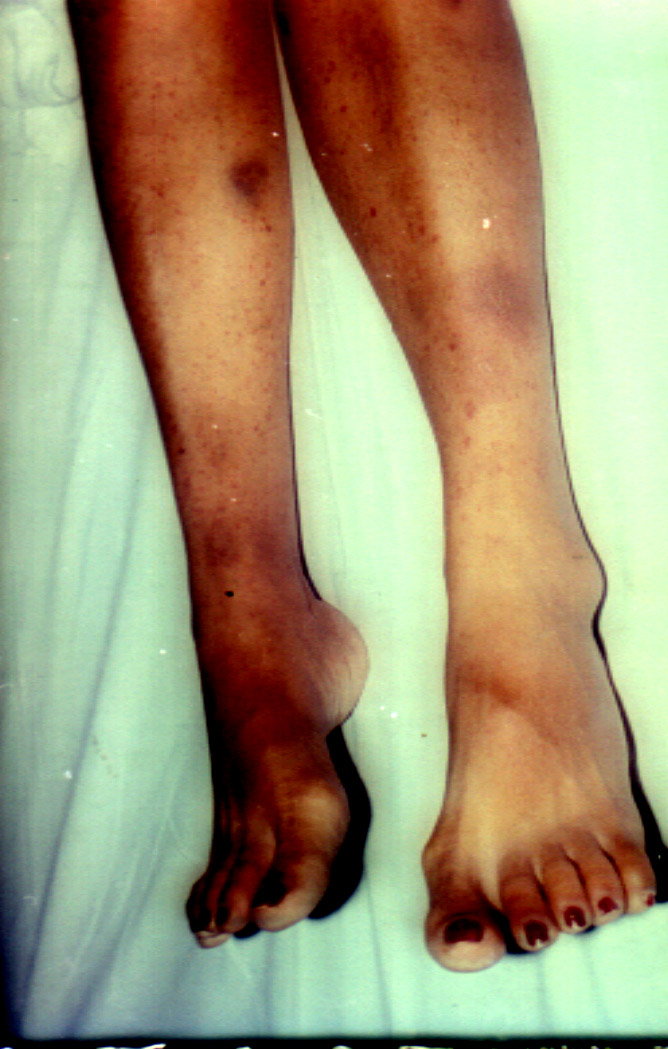 Ômega-3: O Poder Anti-inflamatório Que Acalma o Corpo - inspiração 1