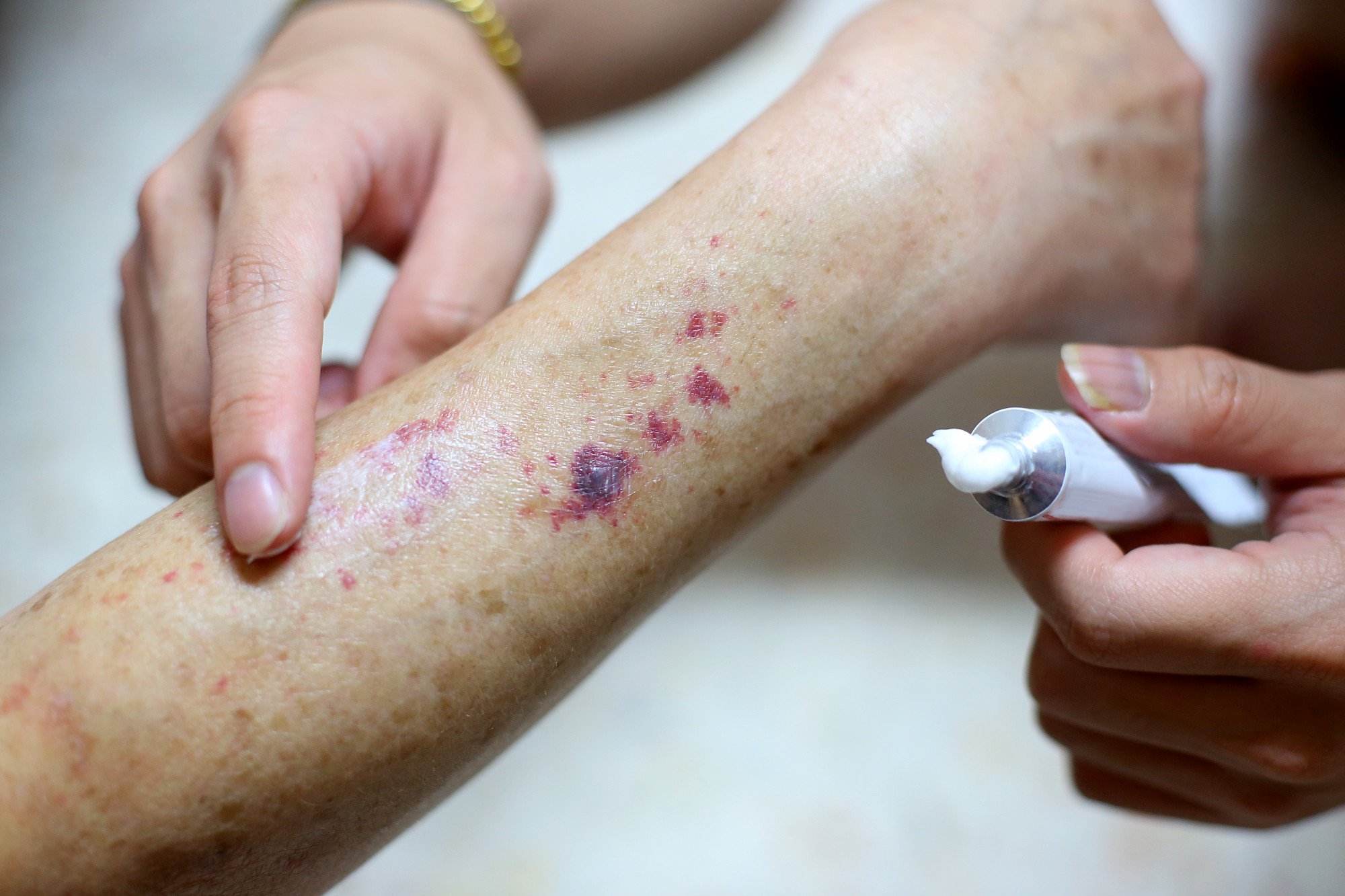 Ômega-3: O Poder Anti-inflamatório Que Acalma o Corpo - inspiração 2