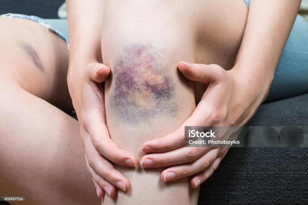 Hidratação Inteligente: A Importância da Água Pura para o Bem-Estar Geral - inspiração 1