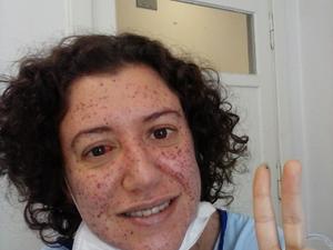 Probióticos: Equilibrando a Flora para uma Imunidade de Ferro - inspiração 3