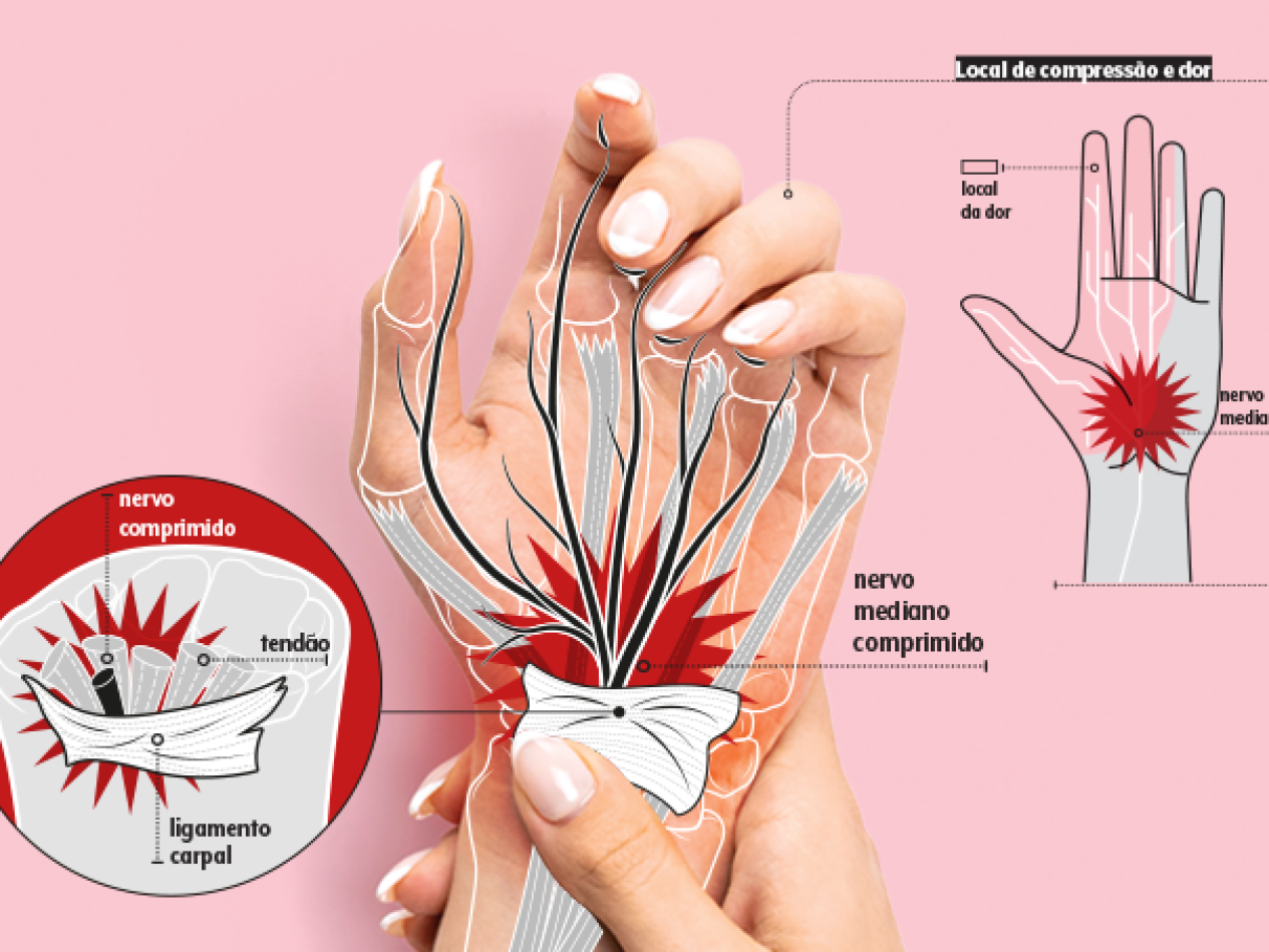 Dica #4: Descubra o Poder Anti-Inflamatório da Cúrcuma (e da Pimenta Preta!) - inspiração 1
