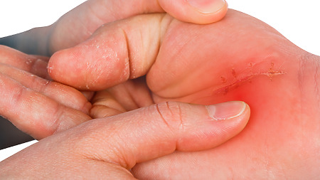 Dica #4: Descubra o Poder Anti-Inflamatório da Cúrcuma (e da Pimenta Preta!) - inspiração 2