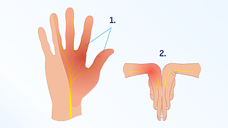 Dica #5: Refresque-se com Abacaxi e sua Enzima Anti-Inchaço - inspiração 3