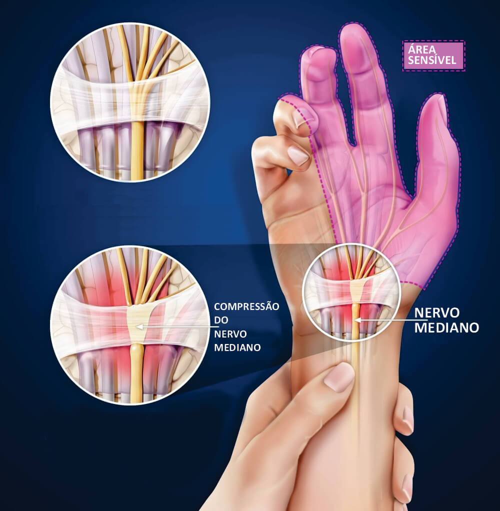 Dica #6: Modere o Sal para Evitar a Retenção de Líquidos - inspiração 3