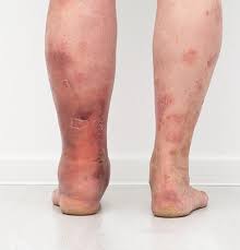 Chocolate Amargo, um Prazer Permitido (e Benéfico) para a Circulação - inspiração 3