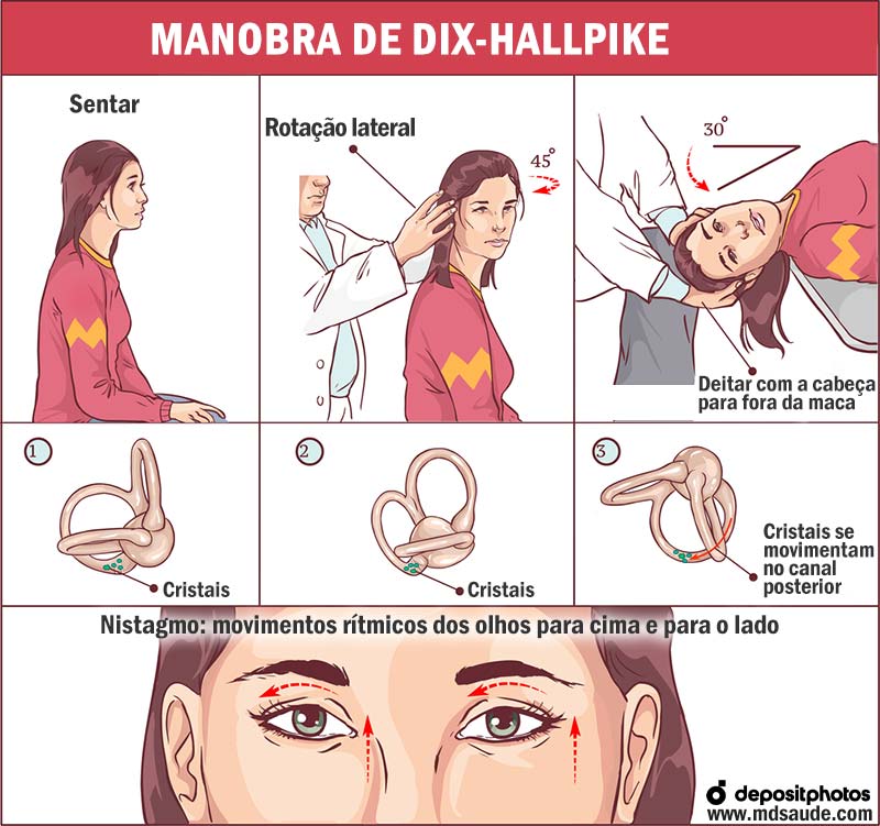 Cálcio: Fortalecendo Seus Ossos e o Ouvido Interno - inspiração 3