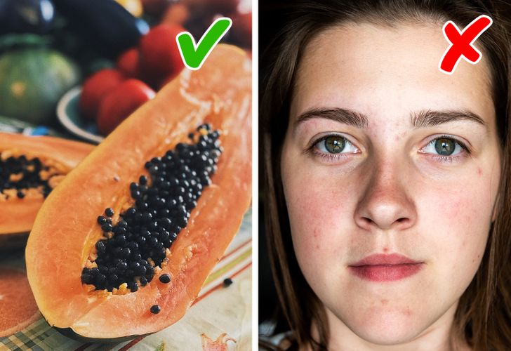 Ultraprocessados: A Bomba Inflamatória Que Detona a Acne - inspiração 3