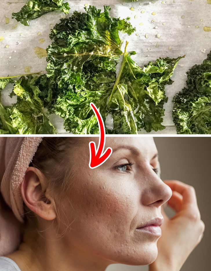 Gorduras Trans e Frituras: A Combinação Explosiva Para a Acne - inspiração 3