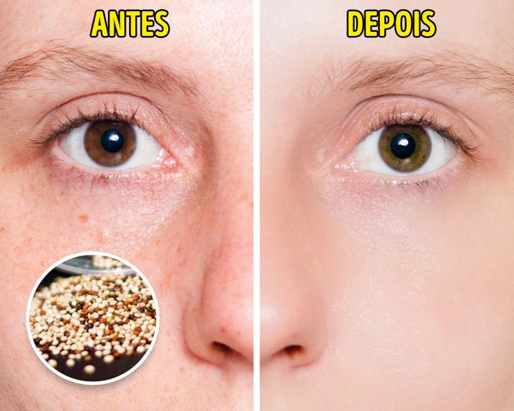 Cuidado com o Glúten: A Sensibilidade Que Pode Agredir Sua Pele - inspiração 1