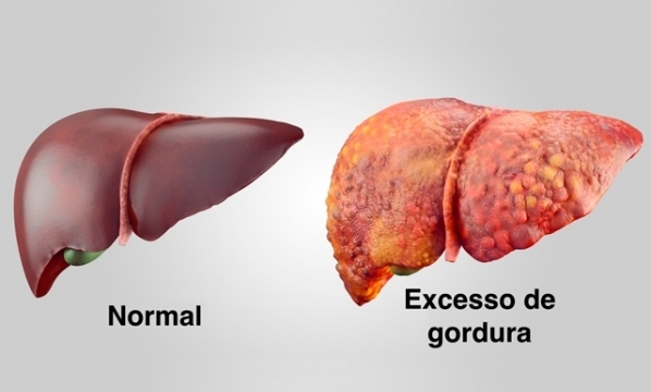 Como Diminuir o Consumo de Açúcar e Carboidratos Refinados No Dia a Dia - inspiração 1