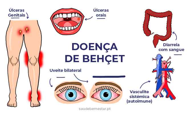 Dica #4: Use e Abuse do Azeite de Oliva Extra Virgem - inspiração 2