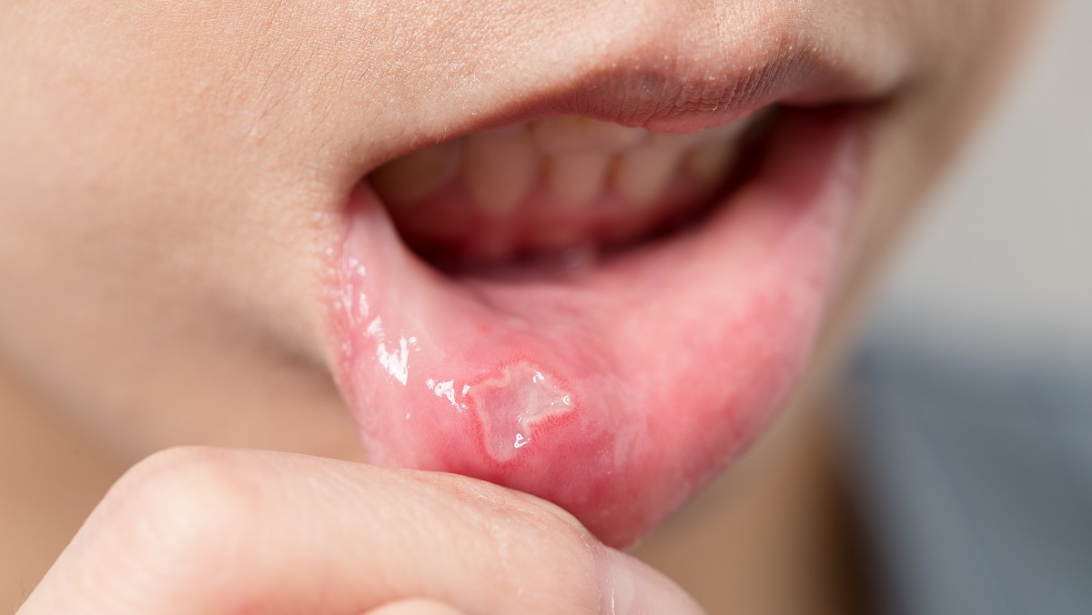 Dica #5: Identifique seus Gatilhos Alimentares com um Diário Detalhado - inspiração 1