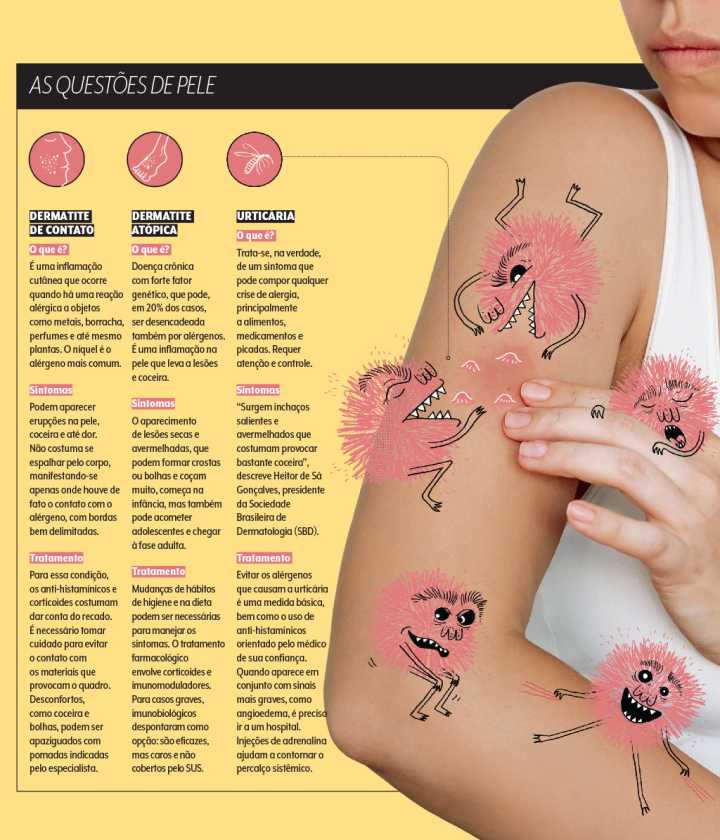 Rinite Gustativa: Como Controlar as Crises Pela Alimentação? - inspiração 1