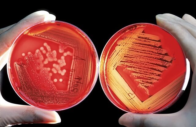 agar agar