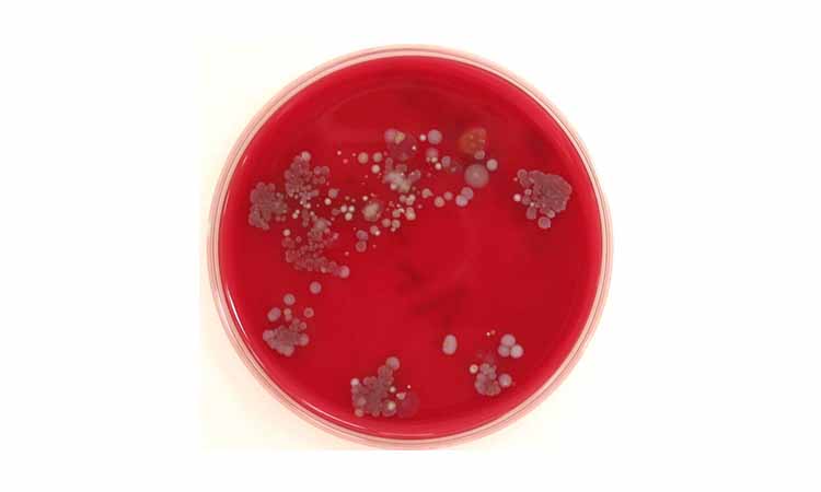 beneficios agar agar
