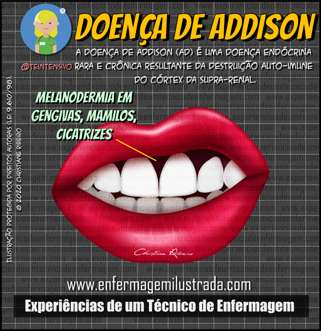 Receitas para Doença de Addison com Baixo Potássio