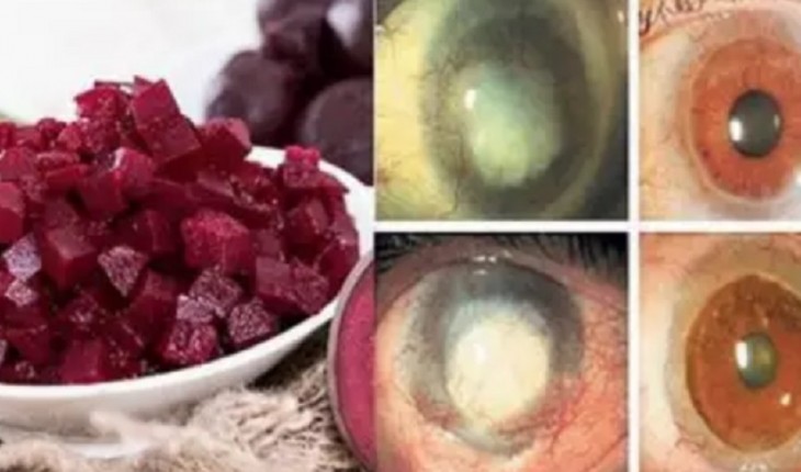 Como o Ômega-3 Beneficia a Visão