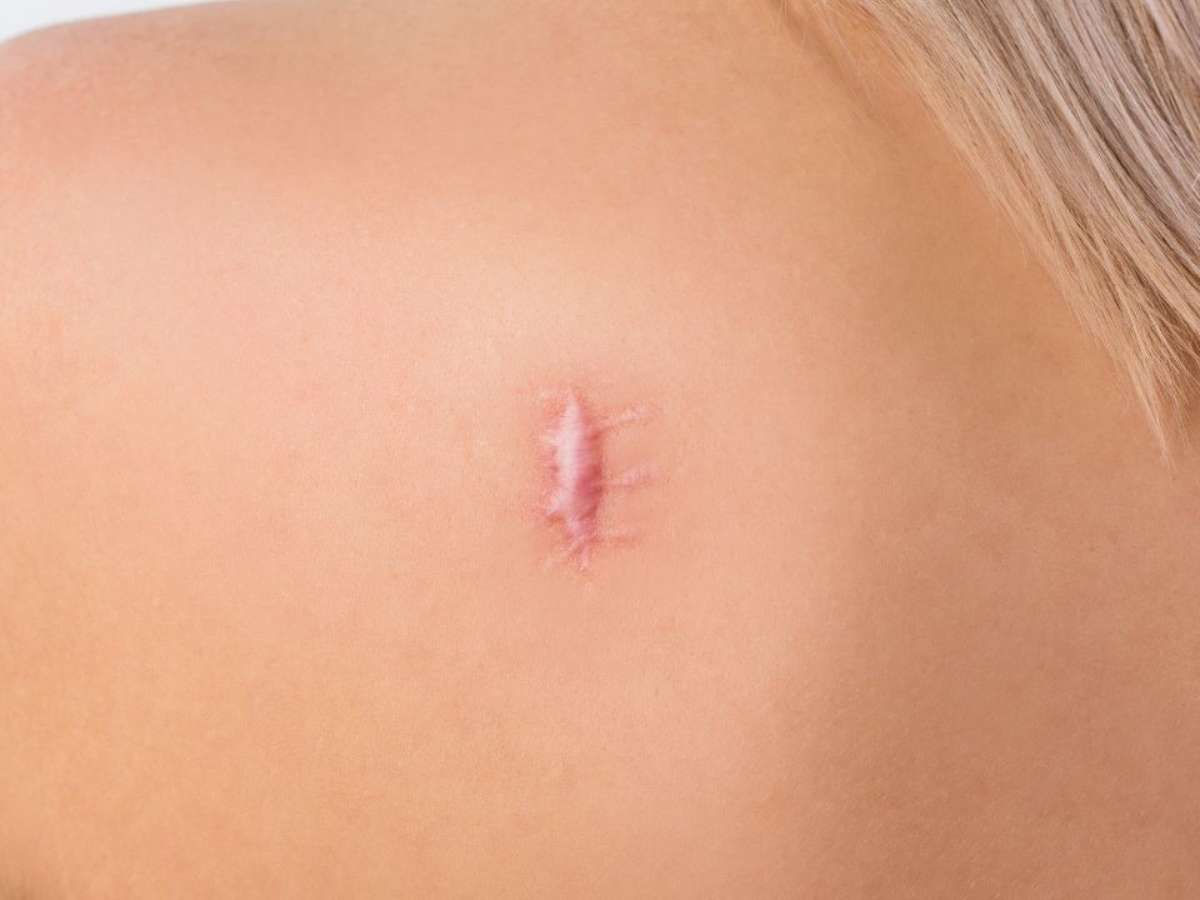 Guia Completo de Nutrientes para a Saúde da Pele Pós-Cirúrgica