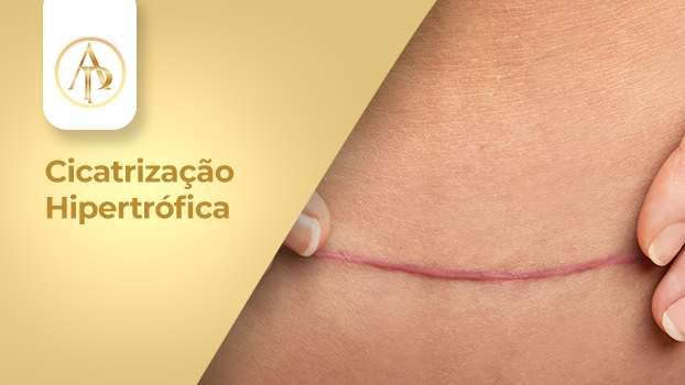 Como a Vitamina C Impacta a Formação de Colágeno