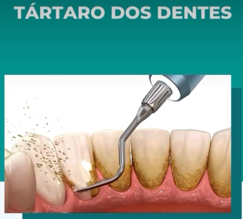 Guia Completo de Alimentos para um Sorriso Saudável