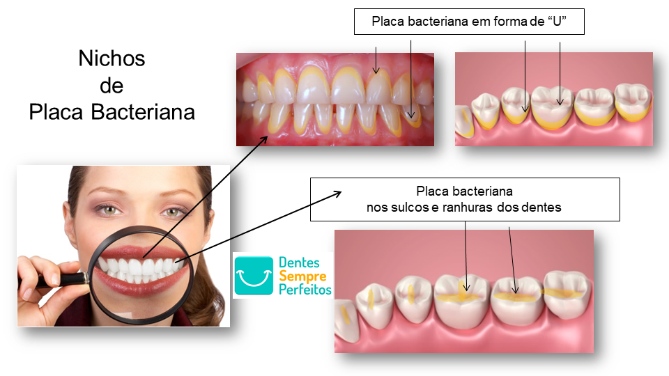 5 Mitos sobre a Formação de Tártaro