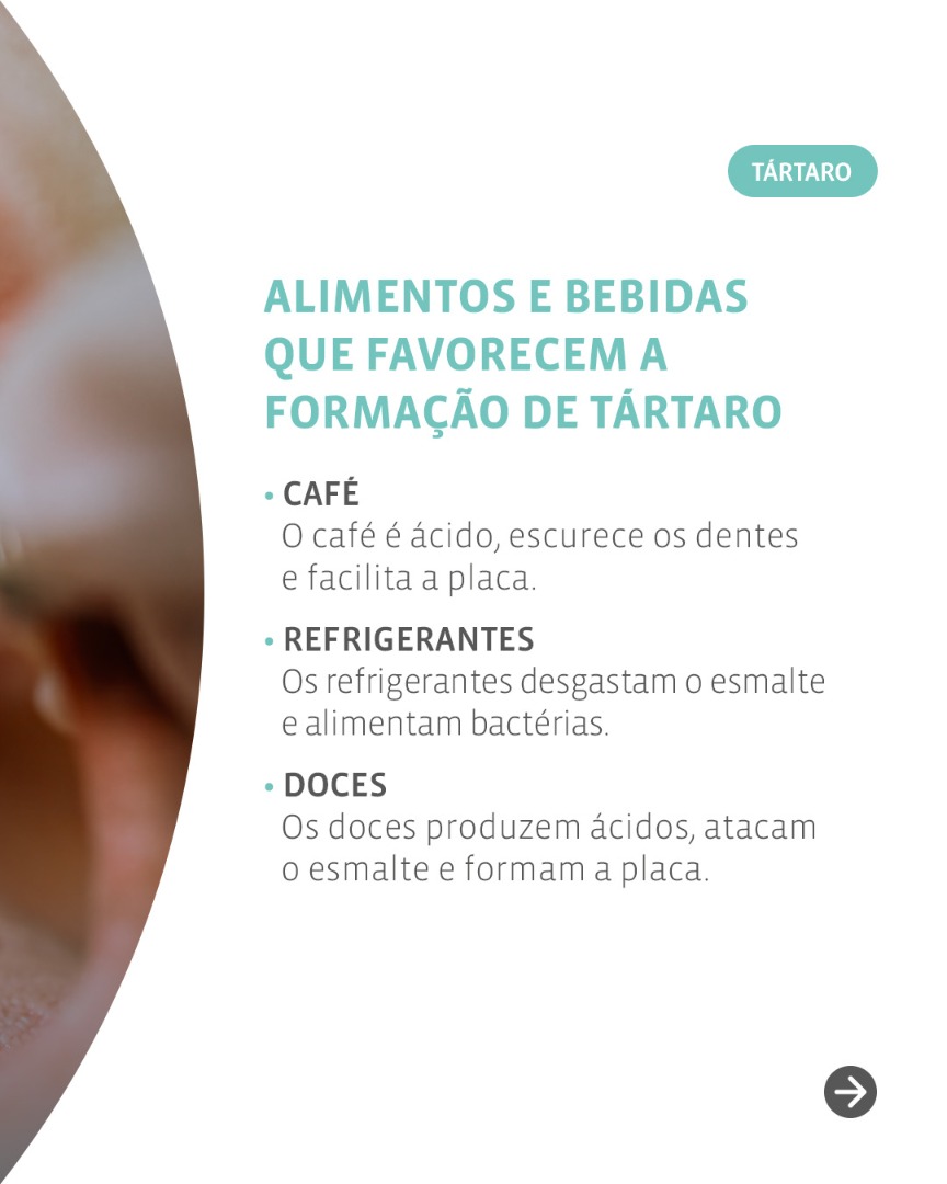 Como a Escovação Correta Complementa a Dieta Anticárie