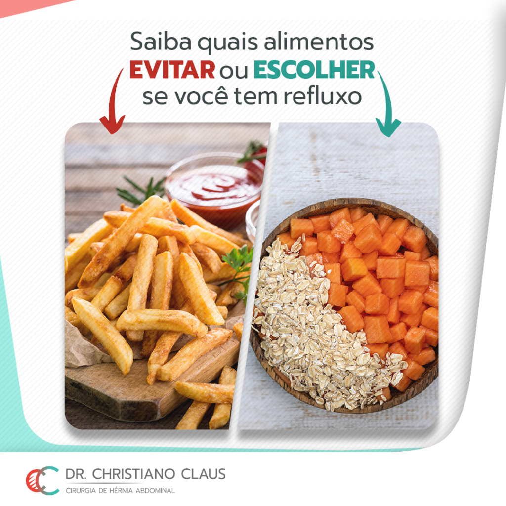 5 Alimentos que pioram a azia