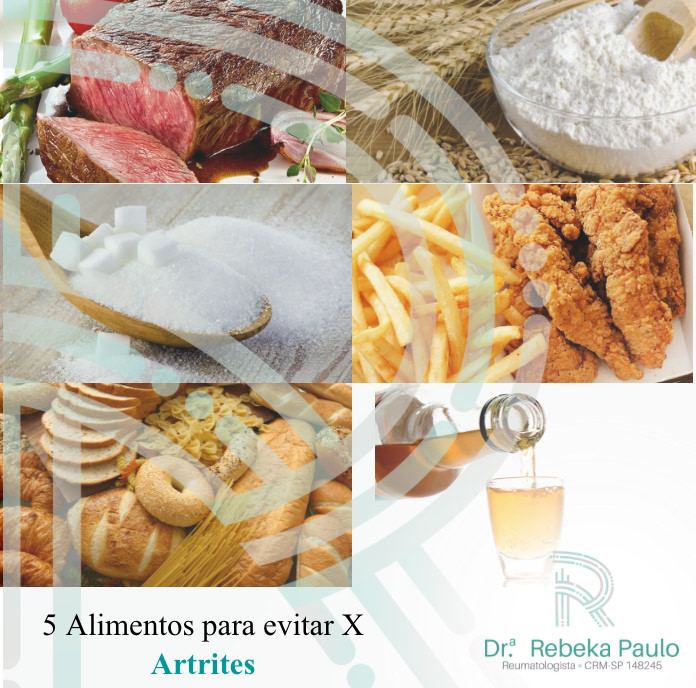 Mitos e Verdades sobre Alimentos e Dores Articulares