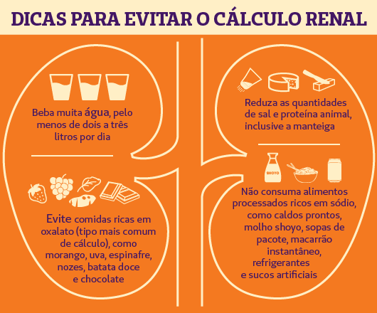 A Importância da Hidratação na Prevenção de Cálculos Renais