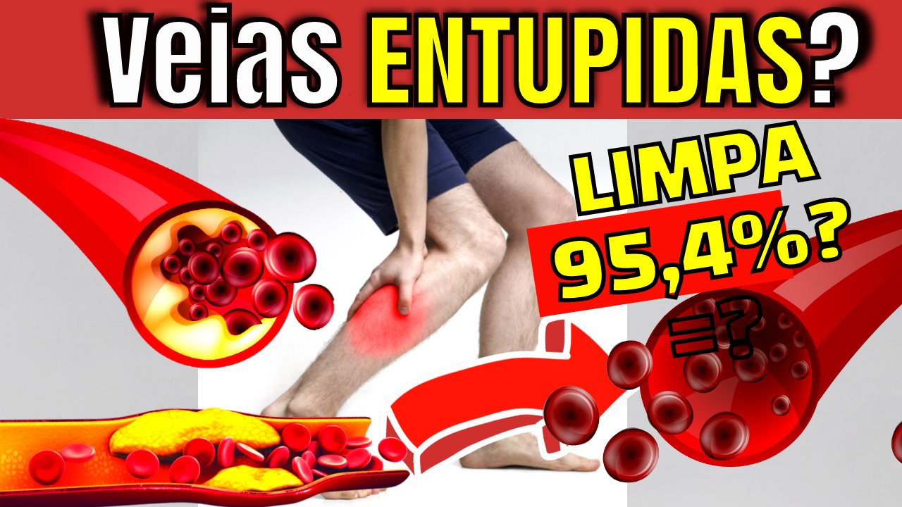 alimentos para limpar as artérias