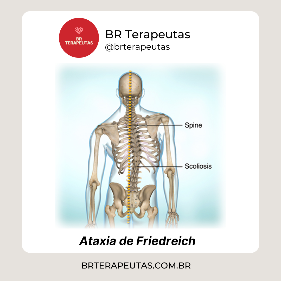 alimentos para quem tem ataxia de friedreich