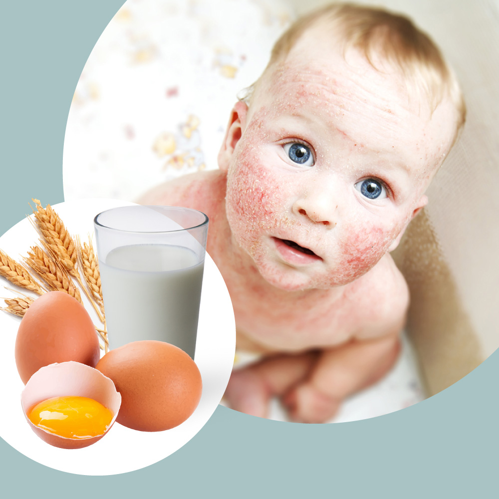 Guia Completo de Alimentos Ricos em Ômega-3 para Pele Saudável