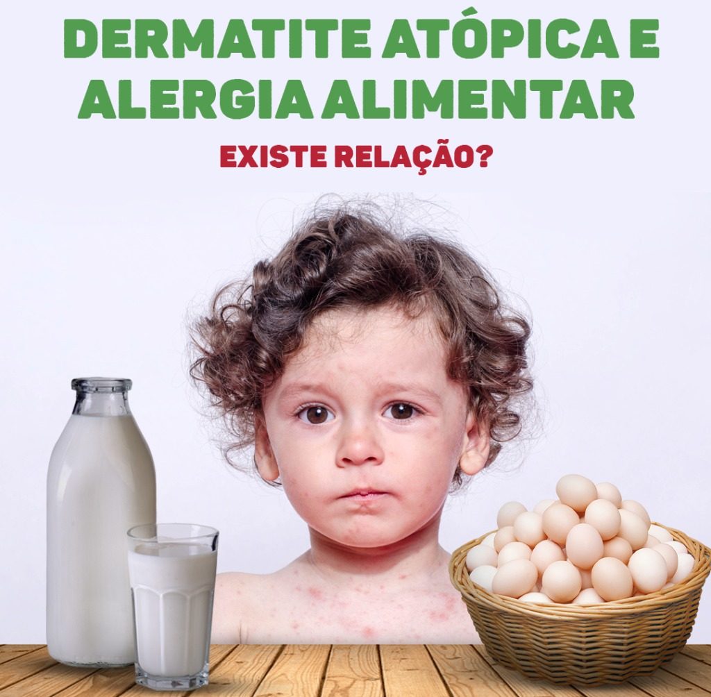 alimentos para quem tem dermatite atópica