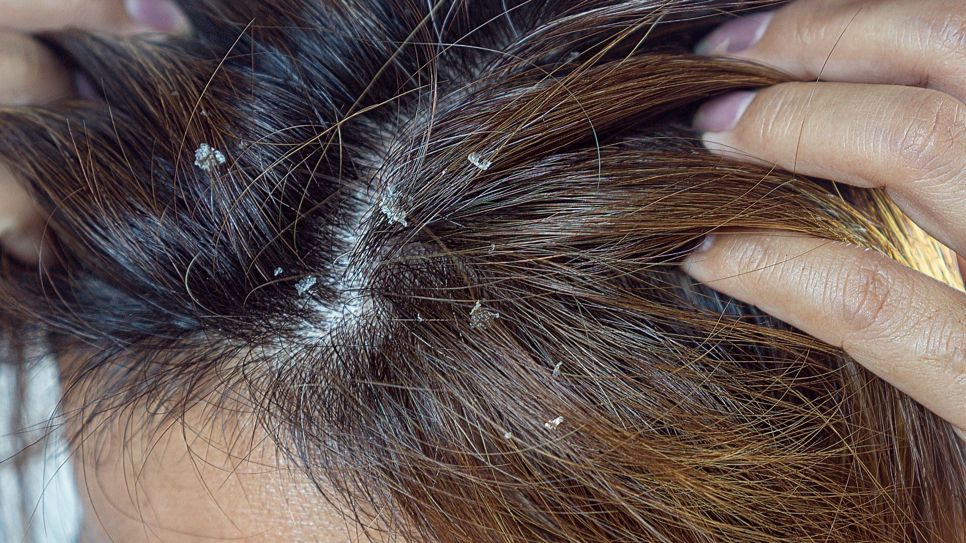 O papel do zinco na regeneração cutânea