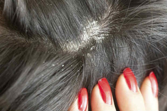 Guia completo de alimentos anti-inflamatórios para a pele