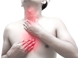 O papel do estilo de vida no controle da esofagite: além da dieta