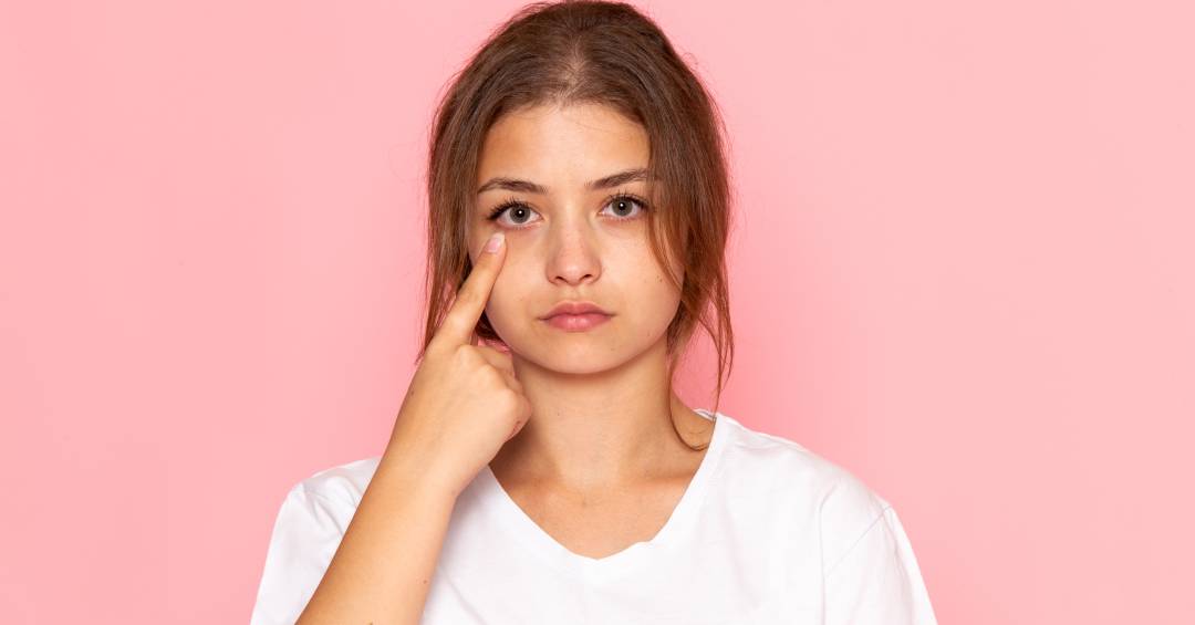 alimentos para quem tem olheiras