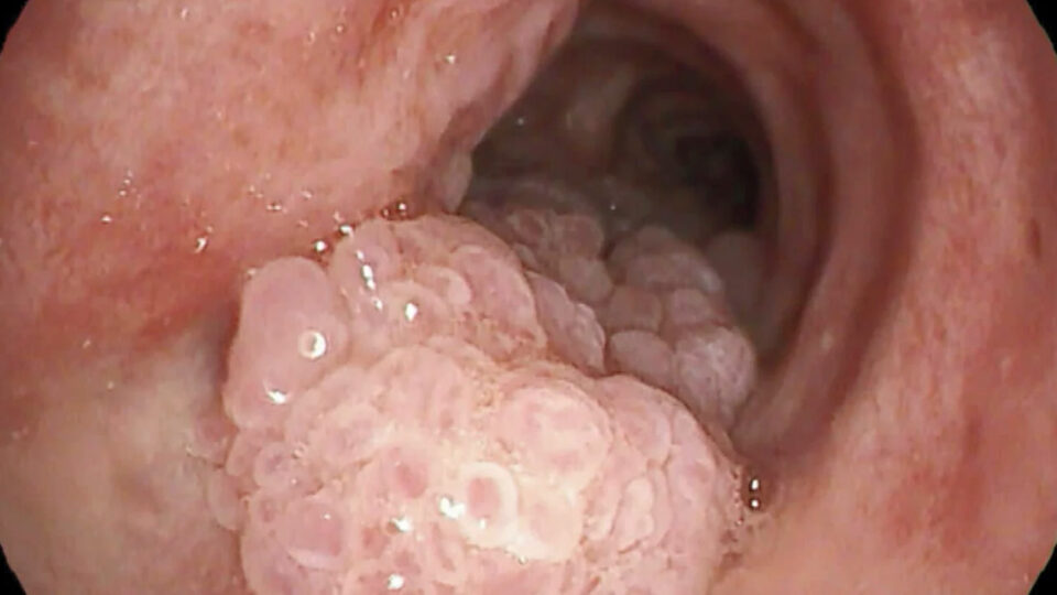 Dieta para Fortalecer o Sistema Imunológico: Guia Completo