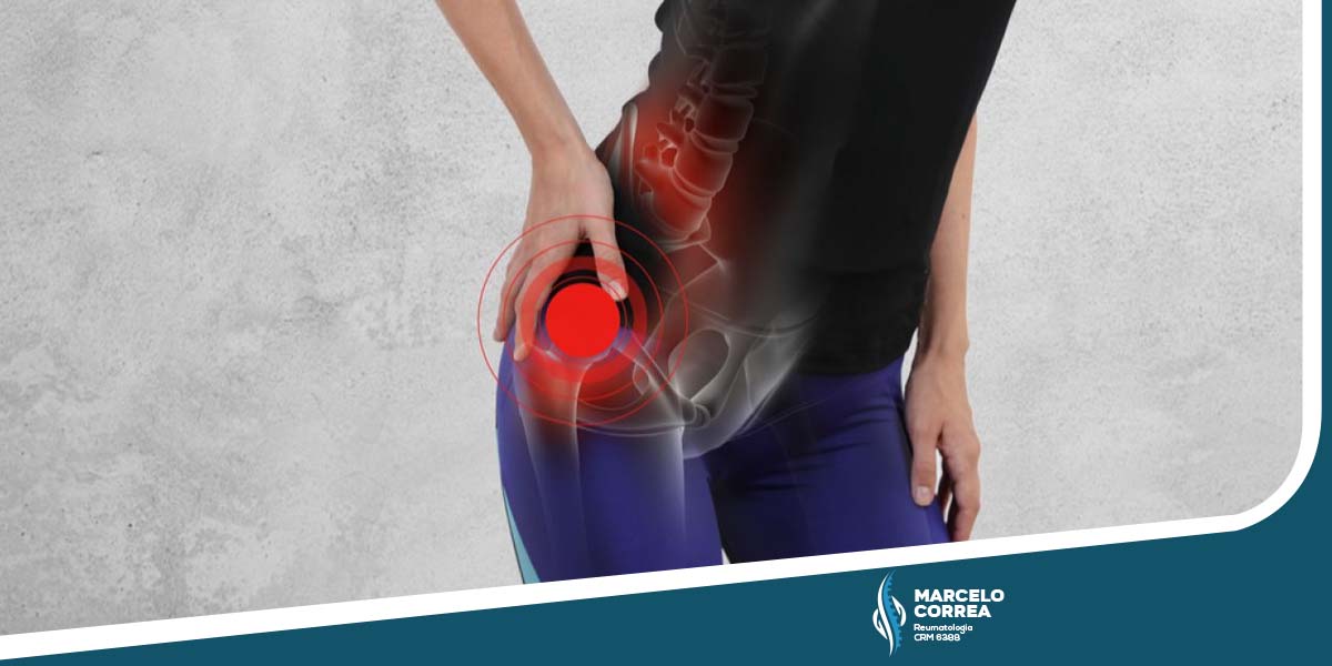 Como a Dieta Mediterrânea Ajuda na Dor Articular