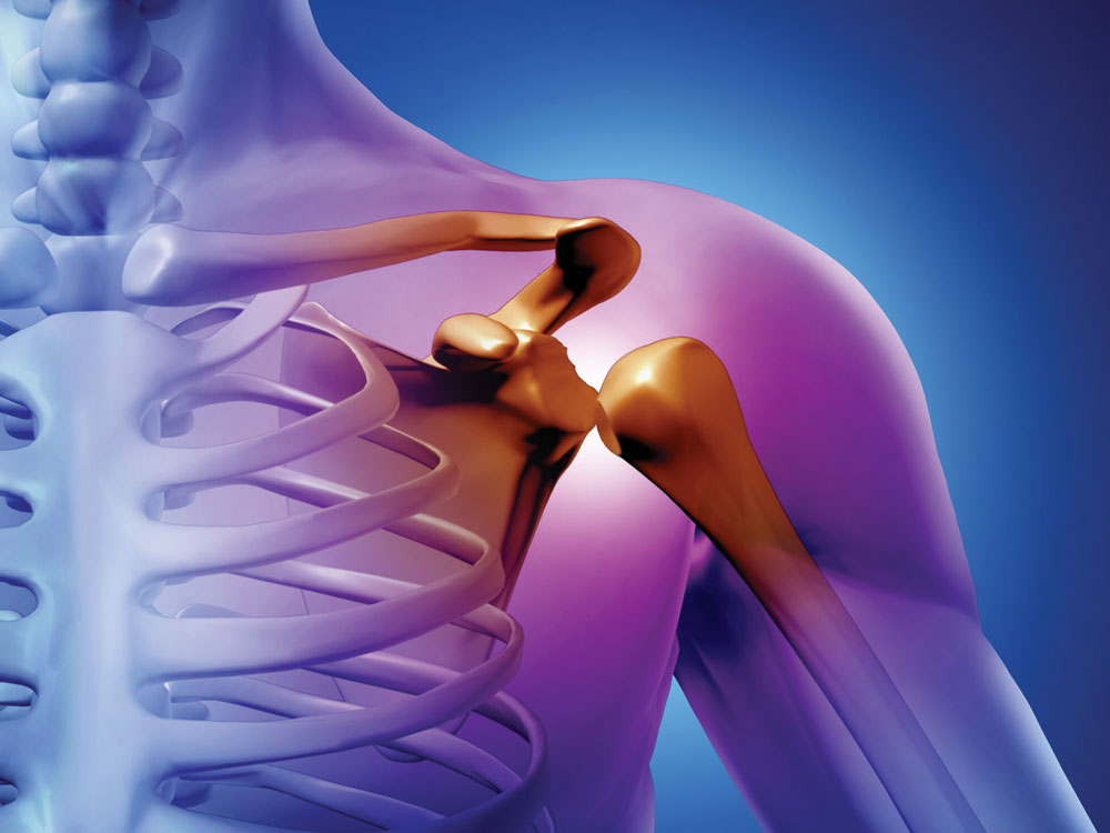 Alimentos Proibidos para quem tem PMR