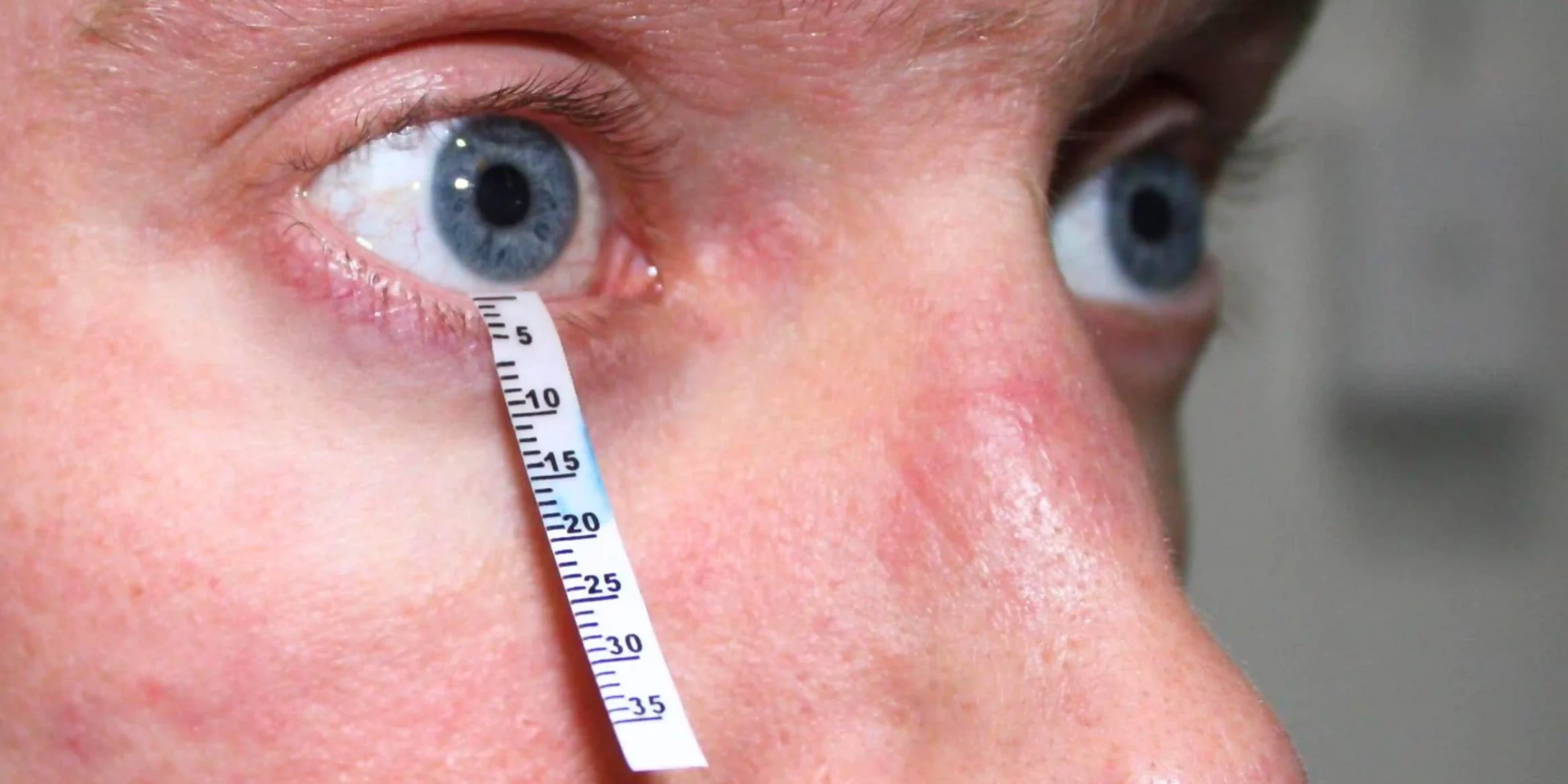 Guia Completo de Hidratação para Pacientes com Sjögren