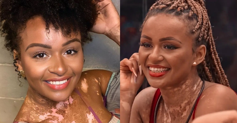 10 Alimentos Ricos em Antioxidantes para Incluir na Sua Dieta