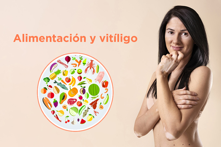 10 Alimentos Ricos em Antioxidantes para Incluir na Sua Dieta